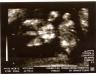 Baby_Sonogram0002_SMALL.jpg